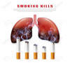 Stop Smoking Campaign Illustration No Cigarette For Health Cigarettes And  Realistic Half Rotten Lungs Royalty Free SVG, Cliparts, Vectors, and Stock  Illustration. Image 169276644.