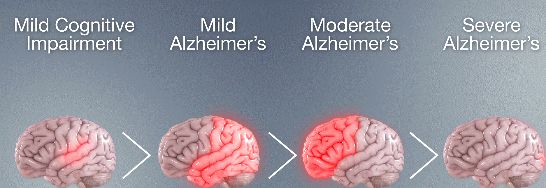 Brain
