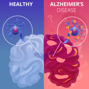 Brain