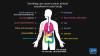 Health Effect
