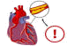 Learn More About Heart Disease | Lifeguarding Academy