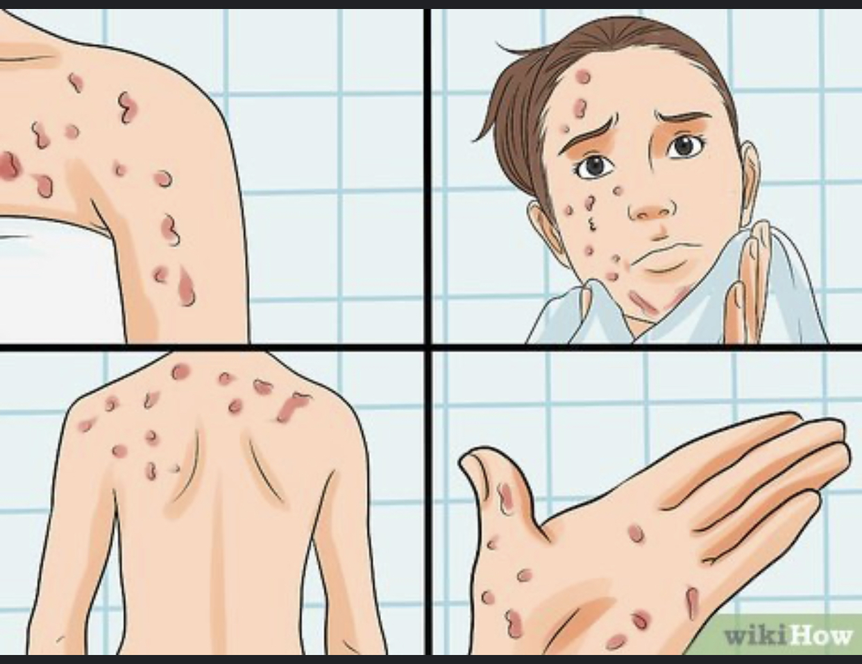 Signs of Aids