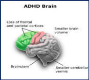 Brain structure