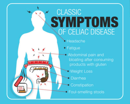 Celiac Symptoms