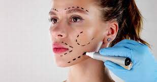 Benefits of Reconstructive Surgery