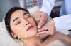 Acupuncture on face
