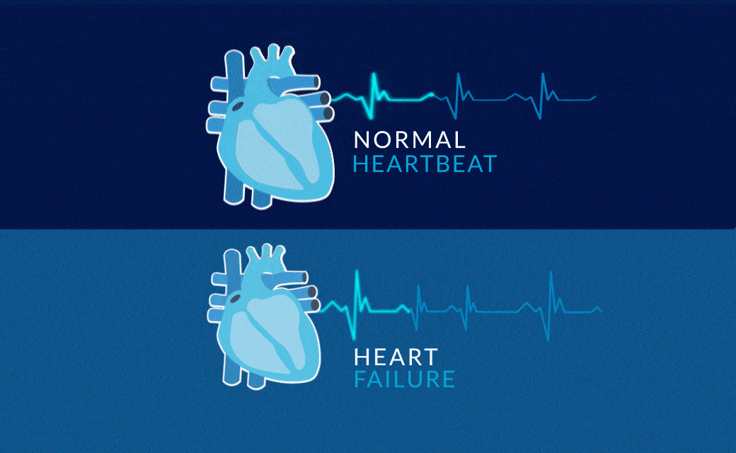 Heartbeat Waves 