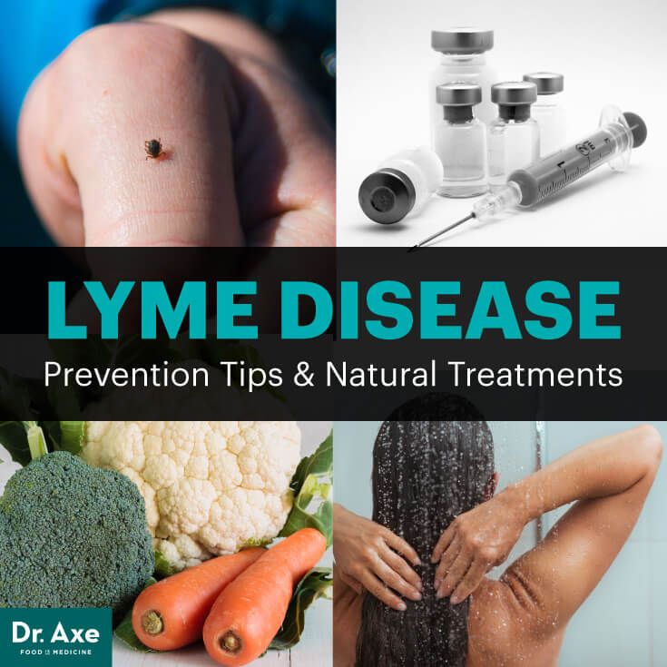 Lyme Disease Prevention Tips + Ways to Naturally Treat | Lyme disease ...