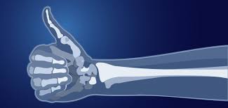 Image of strong bones 