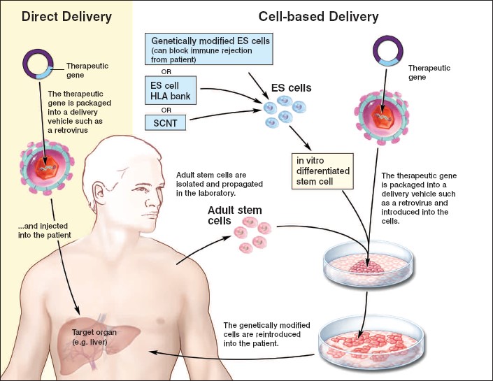 Delivery Systems